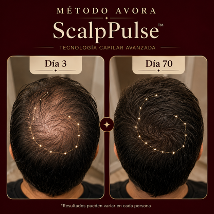 AVORA ScalpPulse™ | Tecnología Capilar Avanzada con Luz Infrarroja