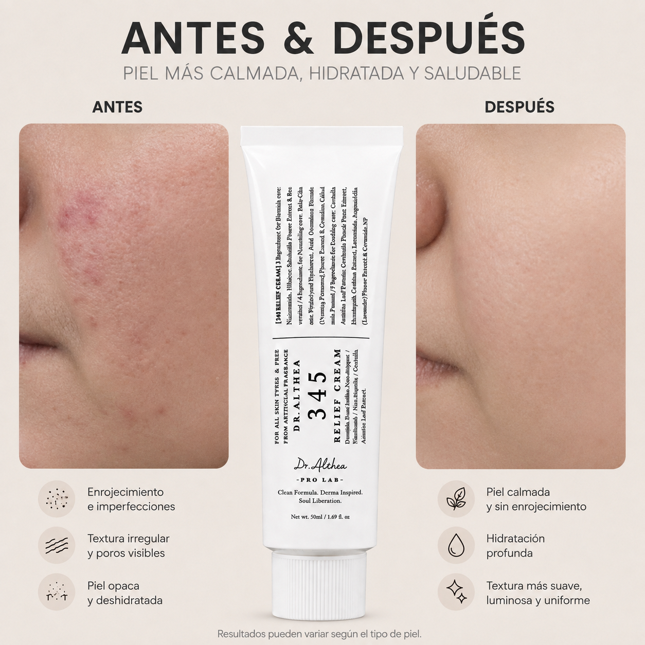 345 Relief Cream ® – Crema calmante | Piel sensible