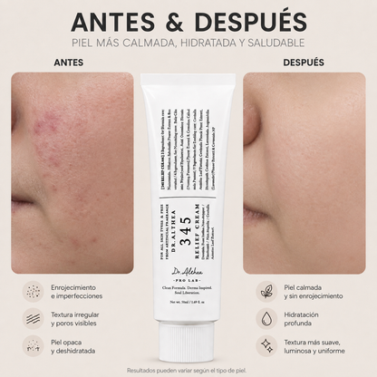 345 Relief Cream ® – Crema calmante | Piel sensible
