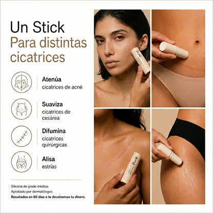 Avora Pure Stick | Elimina cicatrices y marcas de acné